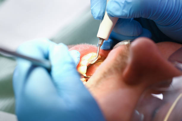 Best Dentist for Severe Toothache  in Andalusia, IL