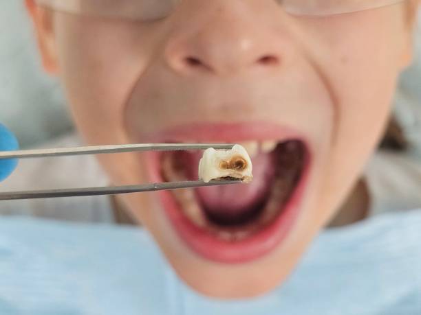 Best Tooth Infection Emergency Dentist  in Andalusia, IL